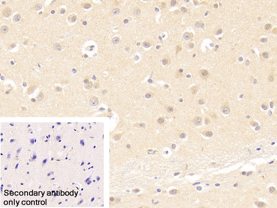 Polyclonal Antibody to Chaperonin Containing TCP1, Subunit 2 (CCT2)