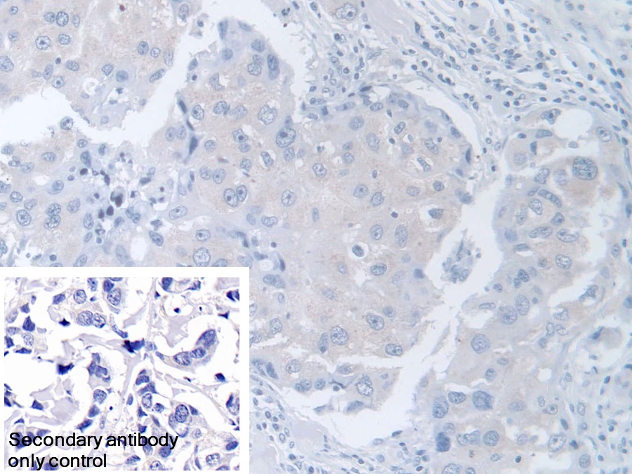 Polyclonal Antibody to Chaperonin Containing TCP1, Subunit 2 (CCT2)