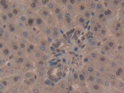 Polyclonal Antibody to CD2 Associated Protein (CD2AP)