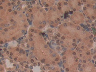 Polyclonal Antibody to CD2 Associated Protein (CD2AP)