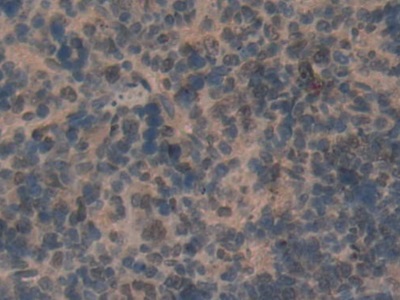 Polyclonal Antibody to CD2 Associated Protein (CD2AP)