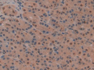 Polyclonal Antibody to CD2 Associated Protein (CD2AP)