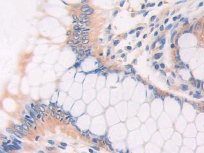 Polyclonal Antibody to Cat Eye Syndrome Chromosome Region, Candidate 1 (CECR1)