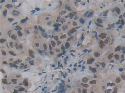 Polyclonal Antibody to DNA Fragmentation Factor Subunit Alpha (DFFa)