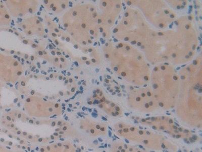 Polyclonal Antibody to DNA Fragmentation Factor Subunit Alpha (DFFa)