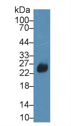 Polyclonal Antibody to DNA Fragmentation Factor Subunit Alpha (DFFa)