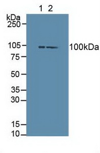 Polyclonal Antibody to Dishevelled, Dsh Homolog 3 (DVL3)