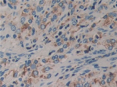 Polyclonal Antibody to Dishevelled, Dsh Homolog 2 (DVL2)