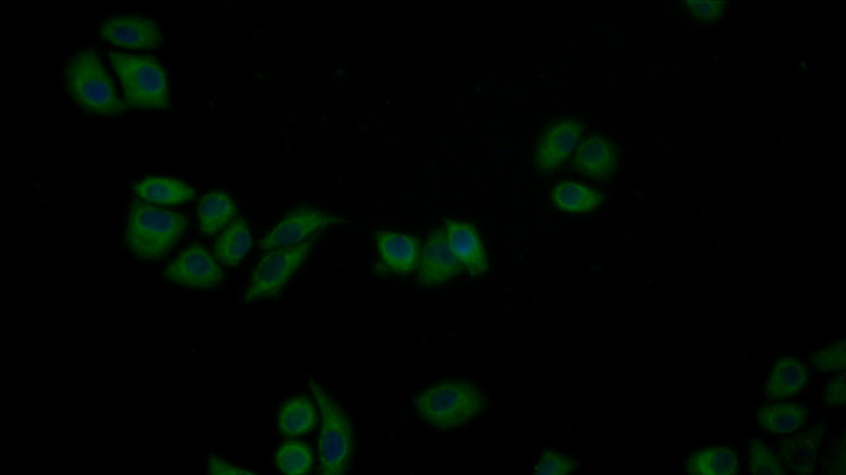 Polyclonal Antibody to Dishevelled, Dsh Homolog 2 (DVL2)