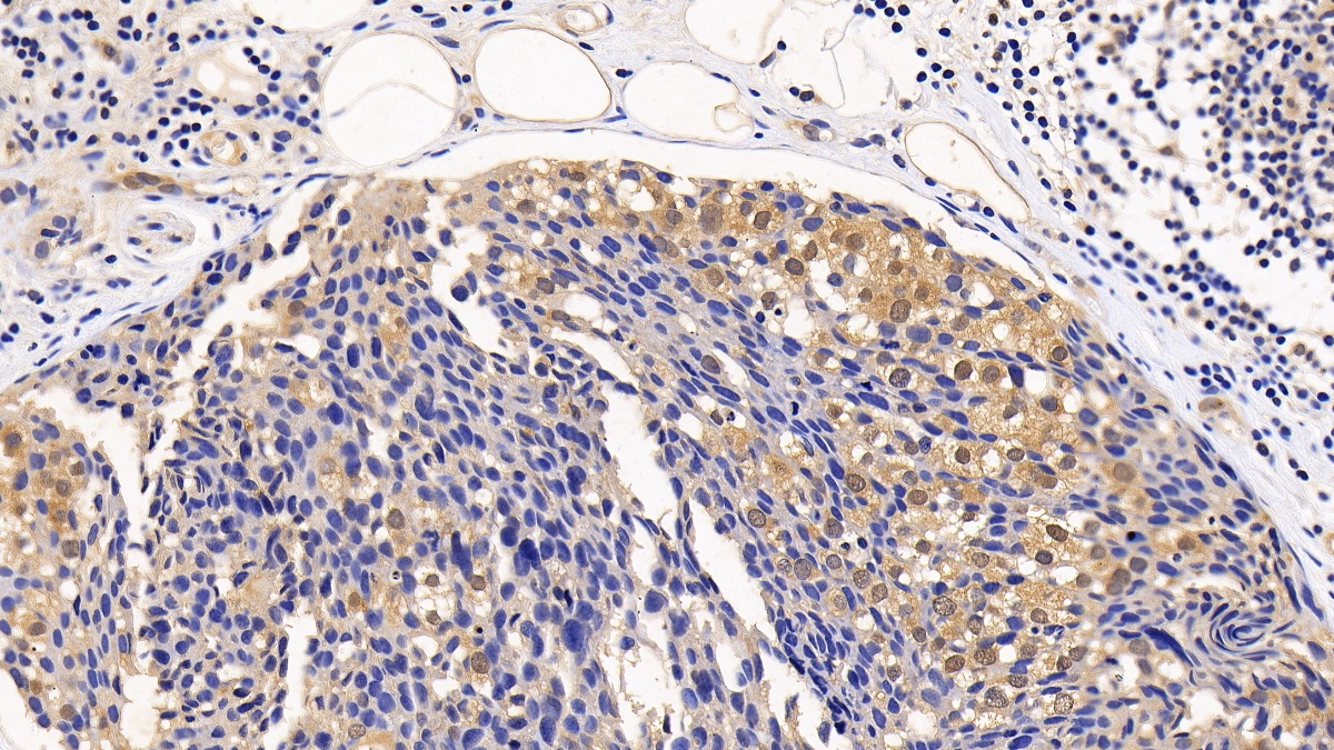 Polyclonal Antibody to Eukaryotic Translation Initiation Factor 4E Binding Protein 1 (EIF4EBP1)