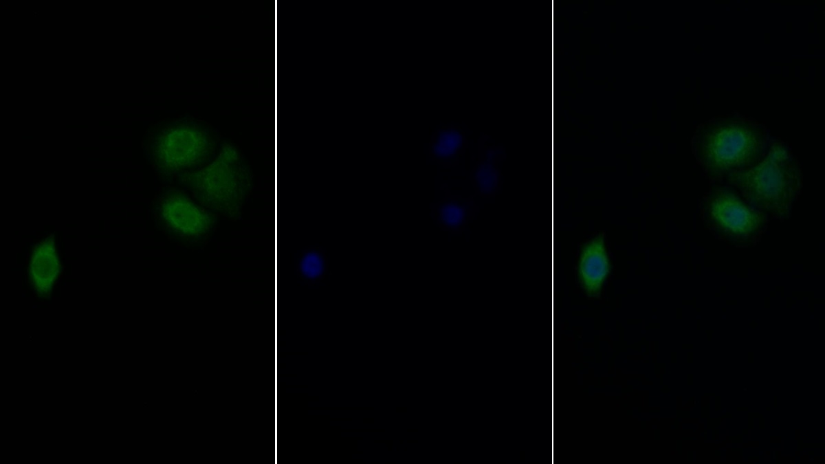 Polyclonal Antibody to Eukaryotic Translation Initiation Factor 4E Binding Protein 1 (EIF4EBP1)