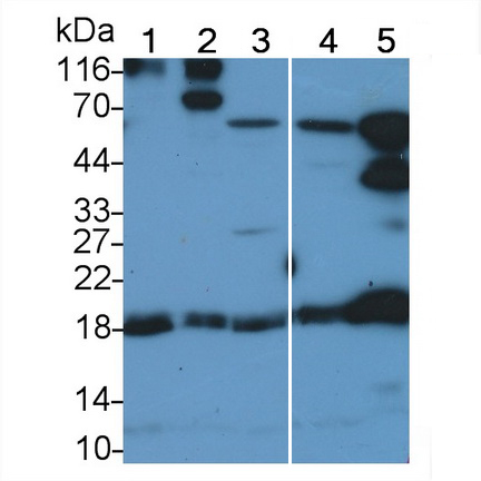 Polyclonal Antibody to Eukaryotic Translation Initiation Factor 4E Binding Protein 1 (EIF4EBP1)