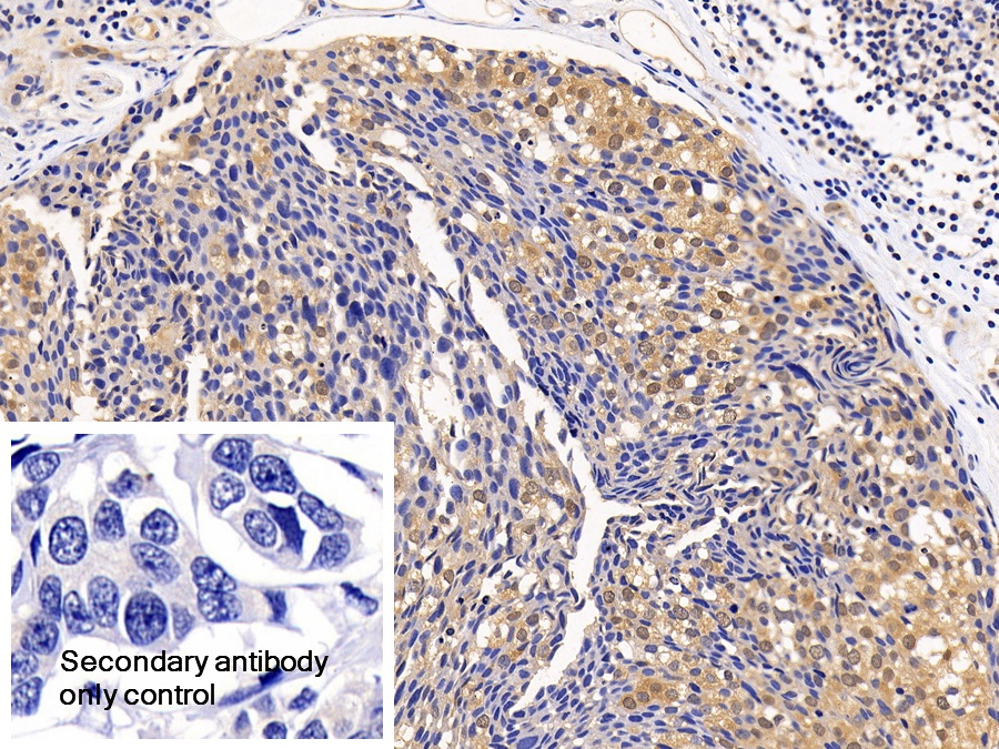 Polyclonal Antibody to Eukaryotic Translation Initiation Factor 4E Binding Protein 1 (EIF4EBP1)