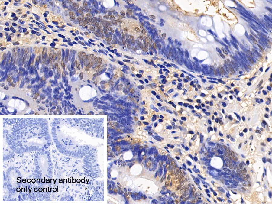 Polyclonal Antibody to Eukaryotic Translation Initiation Factor 4E Binding Protein 1 (EIF4EBP1)