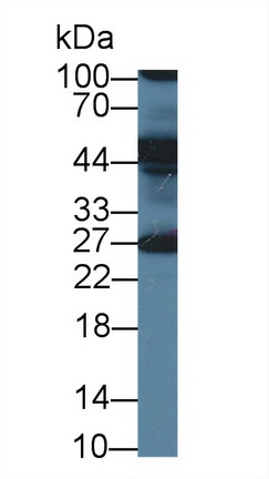 Polyclonal Antibody to Endoplasmic Reticulum Lipid Raft Associated Protein 2 (ERLIN2)