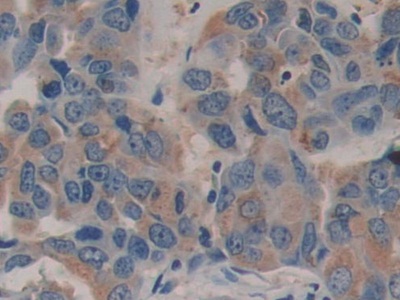 Polyclonal Antibody to Family With Sequence Similarity 3, Member C (FAM3C)