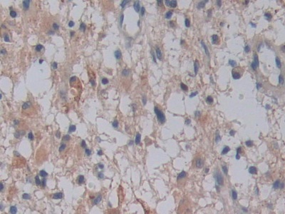 Polyclonal Antibody to Family With Sequence Similarity 3, Member C (FAM3C)