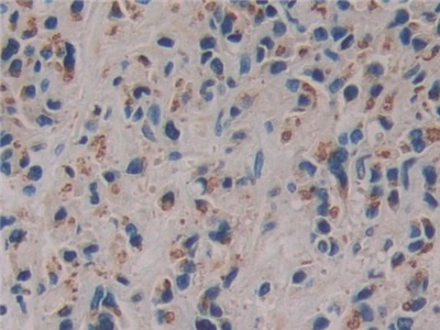 Polyclonal Antibody to Family With Sequence Similarity 3, Member C (FAM3C)