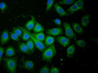 Polyclonal Antibody to Family With Sequence Similarity 3, Member C (FAM3C)