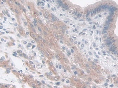 Polyclonal Antibody to Family With Sequence Similarity 3, Member B (FAM3B)