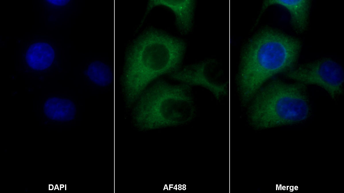 Polyclonal Antibody to FK506 Binding Protein Like Protein (FKBPL)