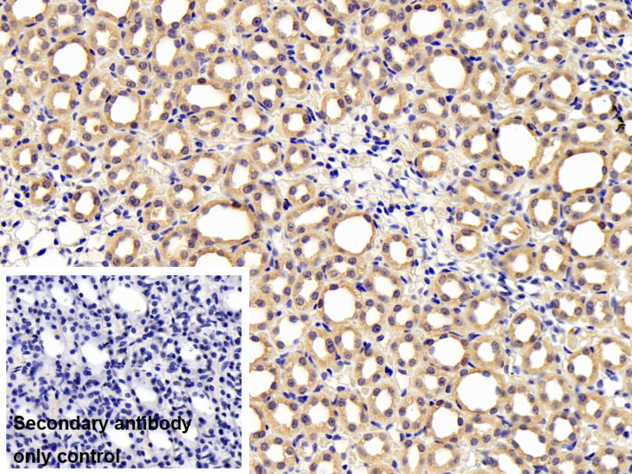 Polyclonal Antibody to FK506 Binding Protein Like Protein (FKBPL)