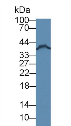 Polyclonal Antibody to FK506 Binding Protein Like Protein (FKBPL)