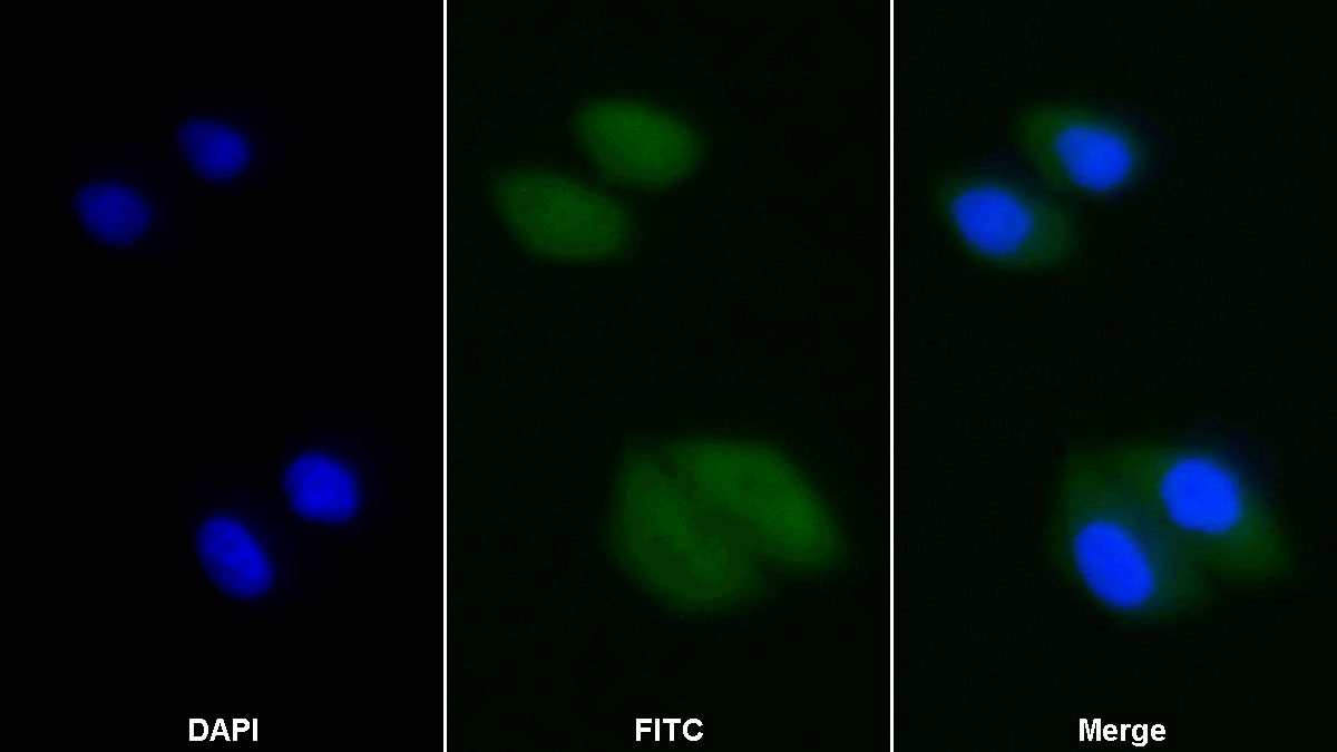 Polyclonal Antibody to FK506 Binding Protein Like Protein (FKBPL)