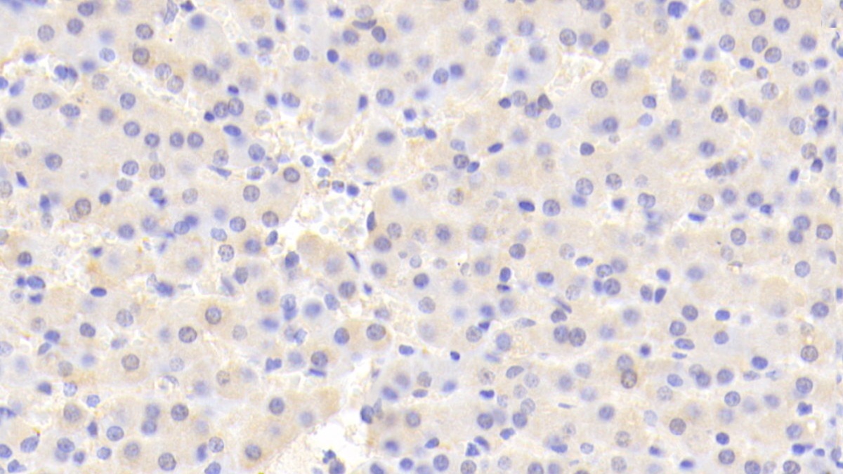 Polyclonal Antibody to Hermansky Pudlak Syndrome Protein 4 (HPS4)