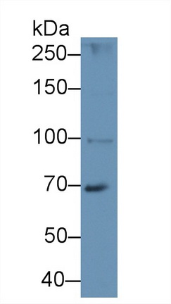 Polyclonal Antibody to Hermansky Pudlak Syndrome Protein 4 (HPS4)