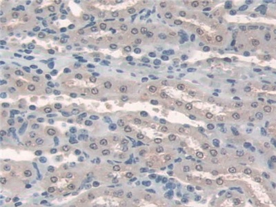 Polyclonal Antibody to Hermansky Pudlak Syndrome Protein 4 (HPS4)