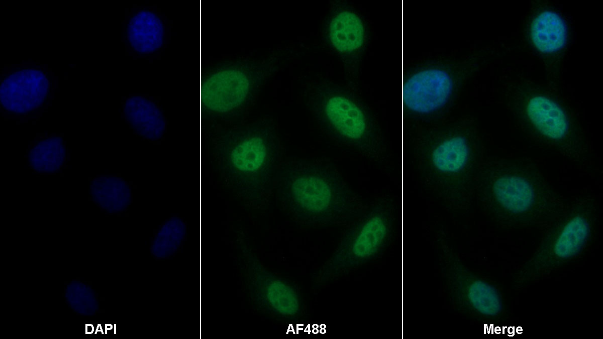 Polyclonal Antibody to Interferon Inducible Protein 35 (IFI35)