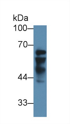 Polyclonal Antibody to Insulin Like Growth Factor 2 mRNA Binding Protein 2 (IGF2BP2)