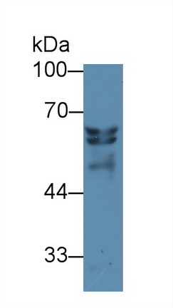 Polyclonal Antibody to Insulin Like Growth Factor 2 mRNA Binding Protein 2 (IGF2BP2)