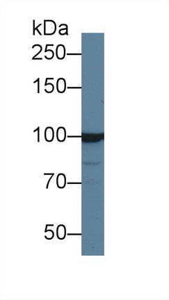 Polyclonal Antibody to Inositol Polyphosphate-4-Phosphatase Type I 107kDa (INPP4A)