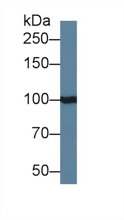 Polyclonal Antibody to Inositol Polyphosphate-4-Phosphatase Type I 107kDa (INPP4A)