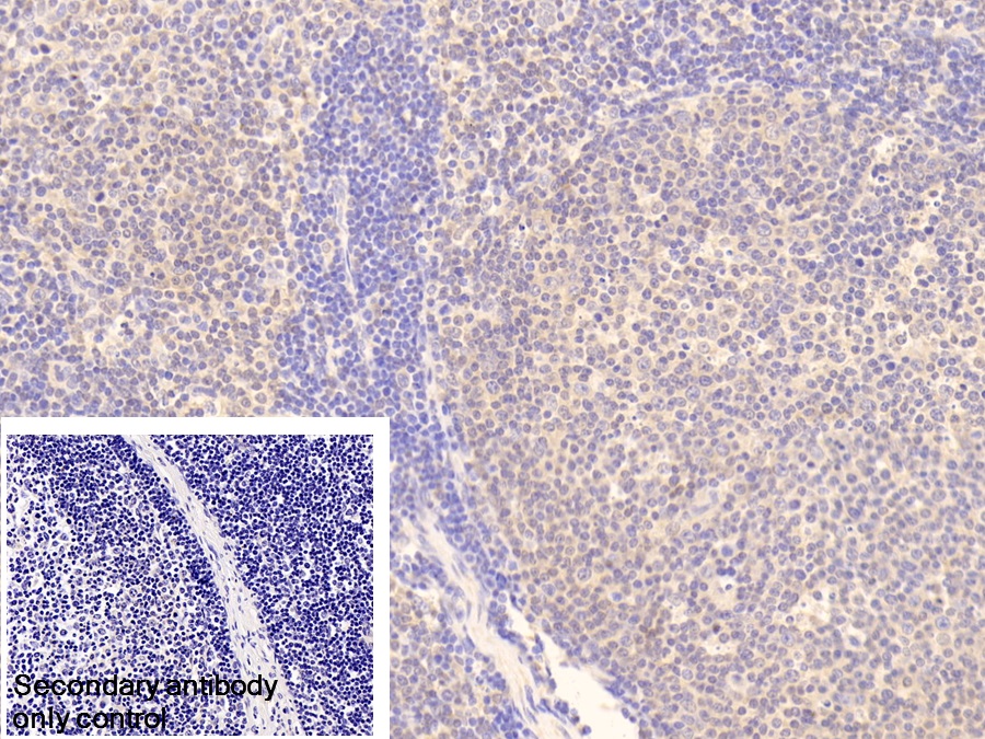 Polyclonal Antibody to Inositol Polyphosphate-4-Phosphatase Type I 107kDa (INPP4A)