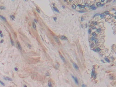 Polyclonal Antibody to Jagged 2 Protein (JAG2)