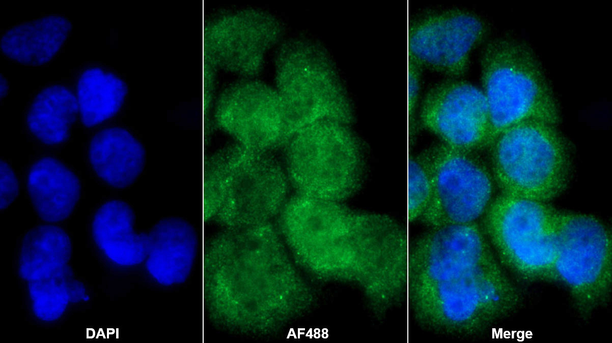 Polyclonal Antibody to Jagged 2 Protein (JAG2)