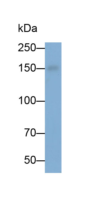 Polyclonal Antibody to Jagged 2 Protein (JAG2)