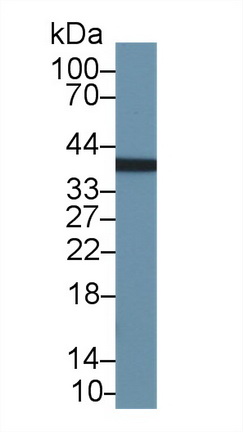 Polyclonal Antibody to Kazal Type Serine Protease Inhibitor Domain Containing Protein 1 (KAZALD1)