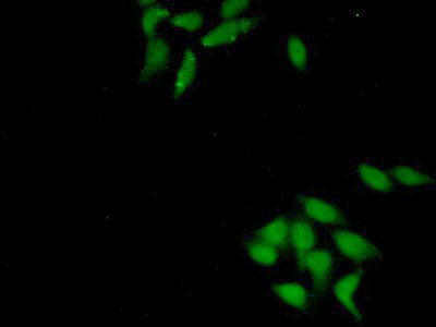 Polyclonal Antibody to Kelch Like ECH Associated Protein 1 (KEAP1)