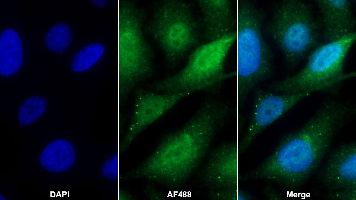 Polyclonal Antibody to Kelch Like ECH Associated Protein 1 (KEAP1)