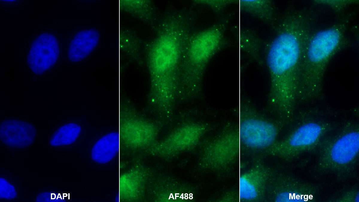 Polyclonal Antibody to Kelch Like ECH Associated Protein 1 (KEAP1)