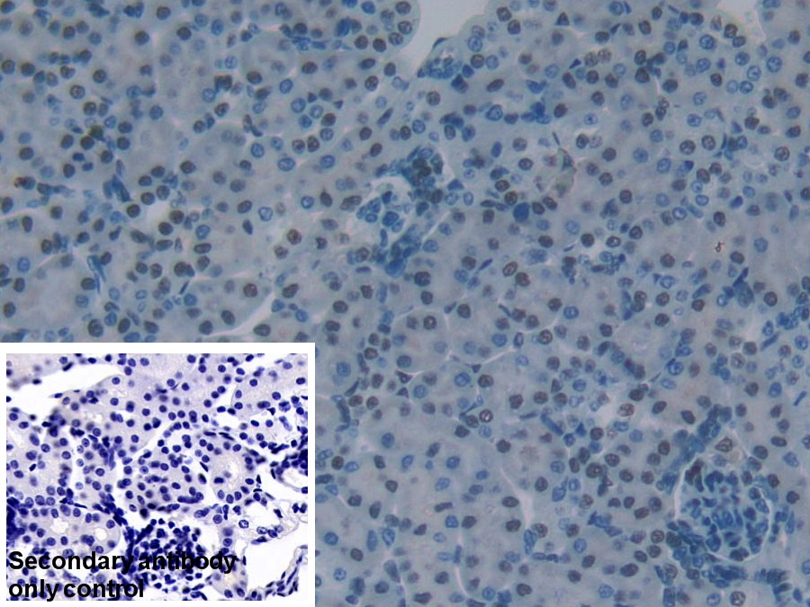 Polyclonal Antibody to KH Domain Containing, RNA Binding, Signal Transduction Associated Protein 1 (KHDRBS1)