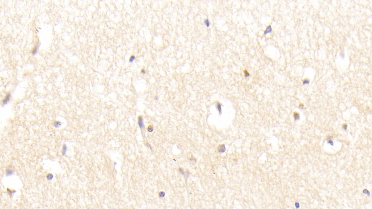 Polyclonal Antibody to Leucine Rich Repeats And Immunoglobulin Like Domains Protein 1 (LRIG1)