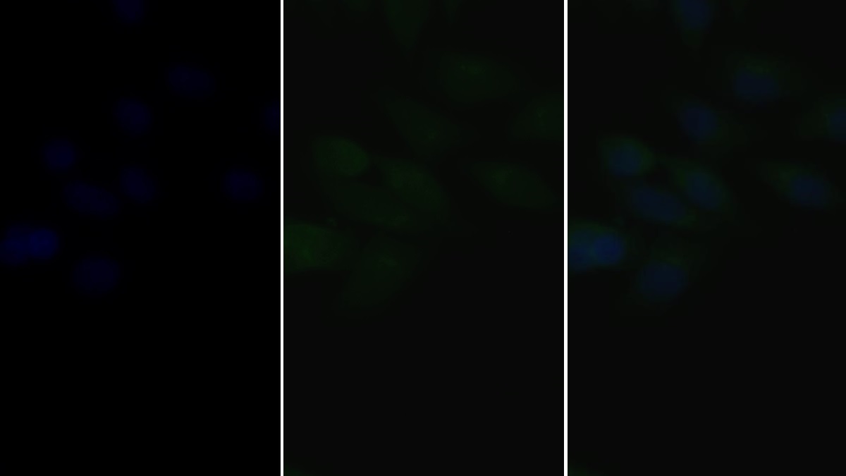 Polyclonal Antibody to Microtubule Associated Protein 1 Light Chain 3 Alpha (MAP1LC3a)