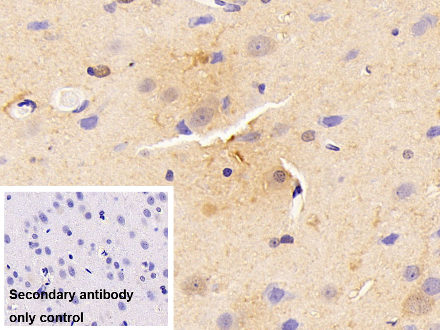 Polyclonal Antibody to Microtubule Associated Protein 1 Light Chain 3 Alpha (MAP1LC3a)