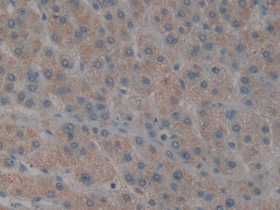 Polyclonal Antibody to Mitogen Activated Protein Kinase Kinase Kinase 7 Interacting Protein 1 (MAP3K7IP1)