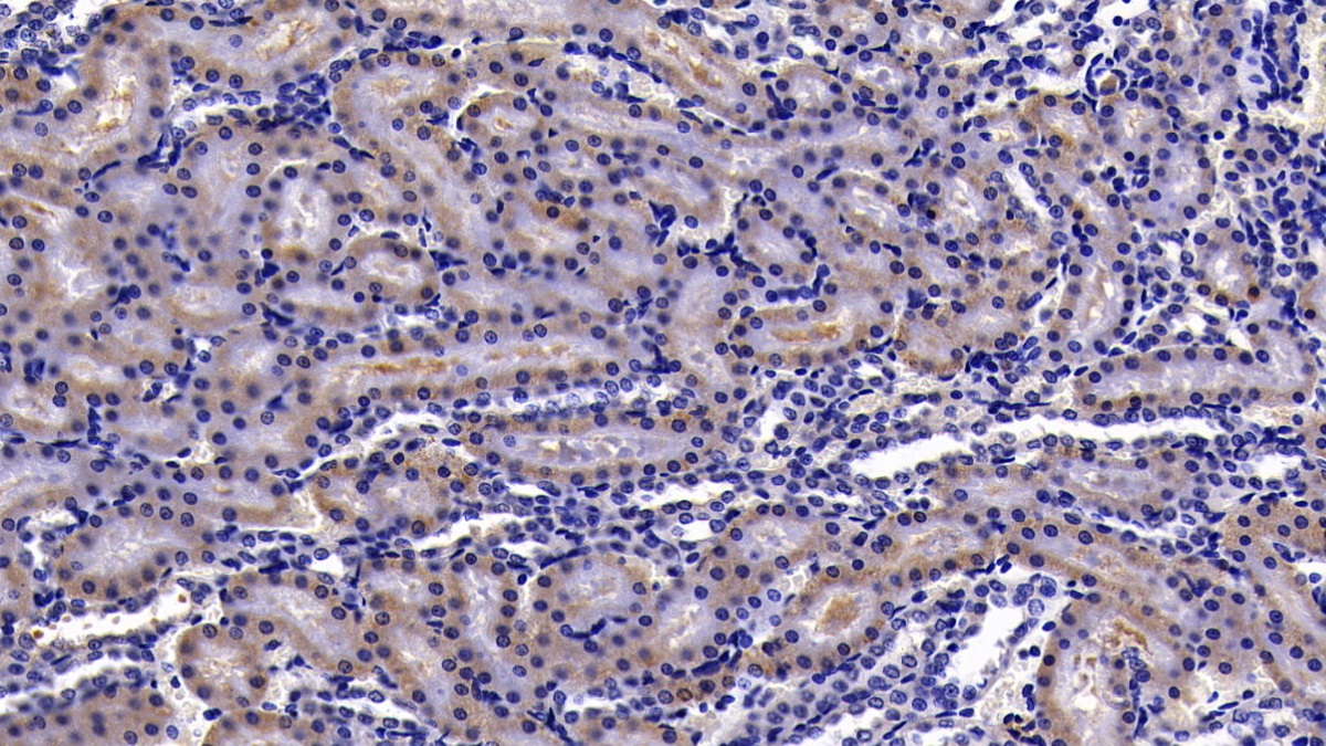 Polyclonal Antibody to Mitogen Activated Protein Kinase Kinase Kinase 7 Interacting Protein 1 (MAP3K7IP1)